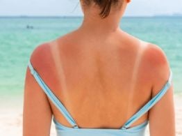 Cómo proteger tu piel del sol este verano: recomendaciones esenciales para cuidarte en Yucatán